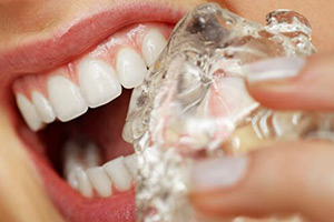 19 привычек, которые могут испортить ваши зубы